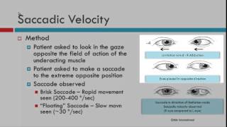 Saccadic Velocity [upl. by Phenica451]