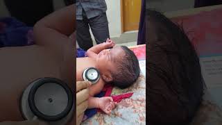 hydrocephalus newborn hydrocephalusbaby congenitalanomaly [upl. by Airtemed]