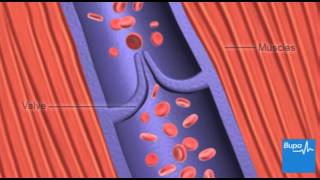 How deep vein thrombosis DVT forms  Bupa Health [upl. by Marsden666]