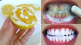 Dentistët nuk ua tregojnë Zbulohet receta si ti zbardhni dhëmbët në kushte shtëpie [upl. by Moshell]