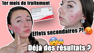 PREMIER MOIS SOUS ISOTRETINOINE ROACCUTANE Je vous dit tout [upl. by Trinetta]