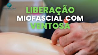 Como fazer a Liberação Miofascial com a ventosa [upl. by Enorahs758]