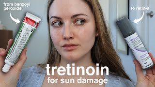 Does Tretinoin RetinA Help With Sun Spots Damage amp Melasma My 4Month Results [upl. by Netsryk915]