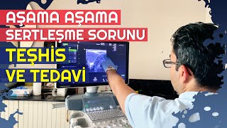 AŞAMA AŞAMA SERTLEŞME SORUNU TEŞHİS VE TEDAVİSİ [upl. by Aynnat690]