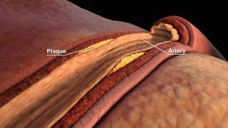 LDL and HDL Cholesterol  Good and Bad Cholesterol  Nucleus Health [upl. by Meingolda89]