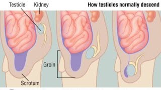 Descend of the Testes Normal Part 02  2nd Year MBBS OSPE [upl. by Ketchan]