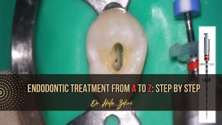 Root canal treatment from A to Z Step by Step [upl. by Hewie]