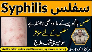 Syphilis سفلس उपदंश Homeopathic Treatmennt By Dr Waqar Bhutta In Urdu  Hindi [upl. by Kopple]