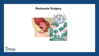 Rectocele Surgery [upl. by Gotthard380]