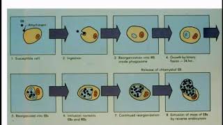 non gonococcal urethritis [upl. by Akenal]