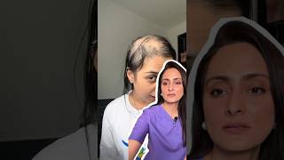 Hair oil for hair growth  dermatologist opines [upl. by Nade96]