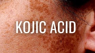 Why Kojic Acid is BEST for Hyperpigmentation and Dark Spots [upl. by Arriaet]