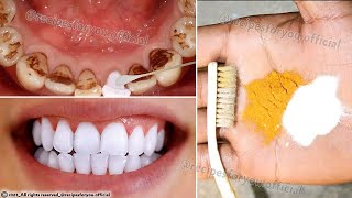 Secret that Dentists dont want you to know Remove Tartar and Teeth Whitening in just 2 minutes [upl. by Annawahs87]