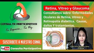 Patologías Oculares de Retina Vitreo y Retinopatía diabética Causas y Daños Consulta P 121124 [upl. by Eeimaj69]