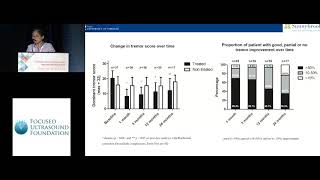 Ying Meng  MRgFUS thalamotomy for treatment of essential tremor a 2year outcome study 2018 [upl. by Colet]