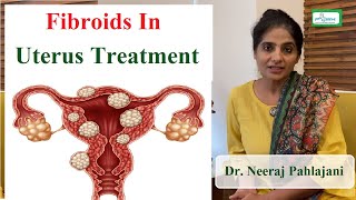 बच्चेदानी में गठान के लक्षण और ऑपरेशन करे या नहीं  Fibroid In Pregnancy [upl. by Saticilef184]