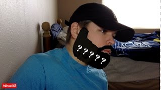 The Sad Truth About Using Minoxidil For Beard Growth  Week 21 Results [upl. by Harimas]