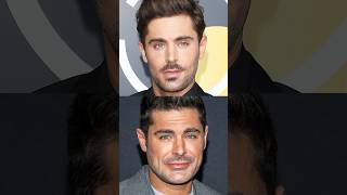 Zac Efron’s New Look Surgeons Set the Record Straight zacefron [upl. by Aicirtel]