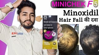 Minichek F 5 Minoxidil Solution Review  Hair Loss Solution [upl. by Einafit]