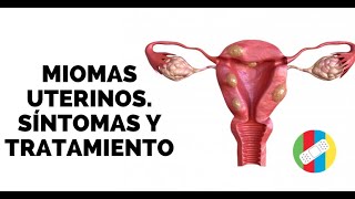 MIOMAS UTERINOS Síntomas y Tratamiento [upl. by Nickles]