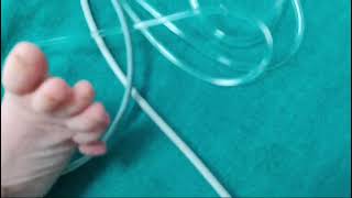 polydactyly baby newlyborn babydevelopment cute [upl. by Ahsil]