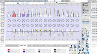 Odontograma  Newsoft DS 11 [upl. by Fang]