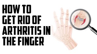 How to get rid of arthritis in the finger  B Episode 128 [upl. by Gollin]