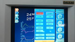 Programación de ventilación mecanica [upl. by Azmuh]