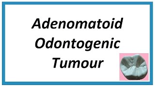 Adenomatoid Odontogenic Tumour  Important notes  Odontogenic Tumors 1  Oral Pathology [upl. by Farand]