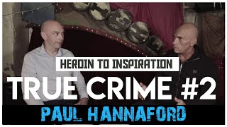 Maggots Save Addicts Leg Paul Hannaford  True Crime Podcast 2 [upl. by Bernj]