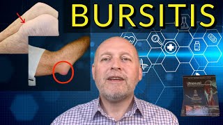 Bursitis in a Nutshell Get it better quickly [upl. by Yadroc541]