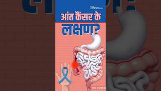 Intestine Cancer Symptomsआंत कैंसर के इन लक्षणों को ना करें इग्नोंर shorts ytshorts trending [upl. by Merchant]