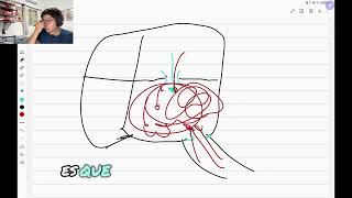 insuficiencia aortica resumen [upl. by Yentroc]