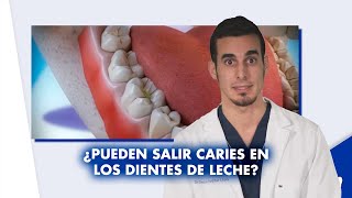 ¿Hay que tratar las CARIES en los DIENTES DE LECHE ¿Se puede usar ORTODONCIA  Shorts [upl. by Oriel]