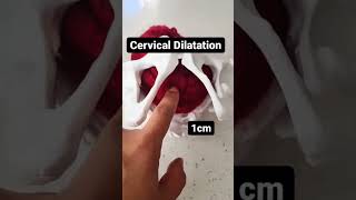 How the cervix dilated Cervical dilation in 20 seconds [upl. by Annunciata185]