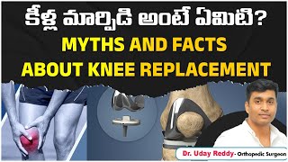 What is Knee Replacement  Myths and Facts of Knee Replacement  Reasons for Knee Pain in Telugu [upl. by Gwenni449]