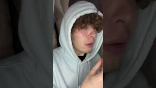 Yes…😭 drole humour sketch tiktok viral france funny shorts prank [upl. by Benisch]