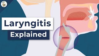 Why Do You Lose Your Voice  Laryngitis Explained [upl. by Arikal]