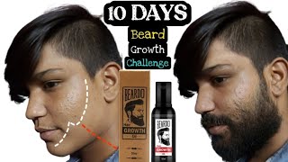 Beardo Beard Growth 90 Days Challenge  Best Beard Oil For Patchy Beard in India 2024 [upl. by Elaine141]