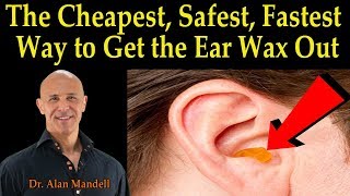 Cheapest Safest Fastest Way to Get the Ear Wax Out  Dr Alan Mandell DC [upl. by Ellenahs824]