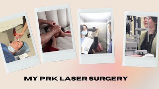 MY PRK LASER SURGERY  chirurgie de la myopie au laser PKR [upl. by Ortensia780]