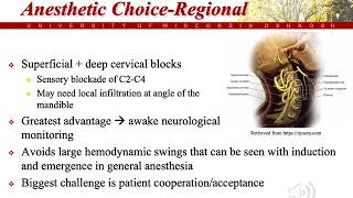 CEA Overview and Anesthetic Choices For CEA [upl. by Iver686]