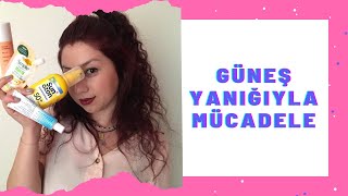 BEN YANDIM SİZ YANMAYIN  GÜNEŞ YANIĞI NASIL GEÇER 🌞 [upl. by Ettennal358]