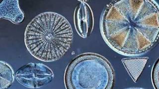 Beautiful Diatoms [upl. by Ihtak]