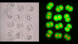 Early embryonic development of mouse [upl. by Somerville]