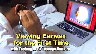 Viewing Earwax for the first time using Teslong USB Otoscope Camera [upl. by Ardied]