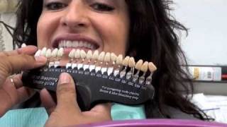 Teeth Whitening in the Salon to Make more Money [upl. by Ainer]