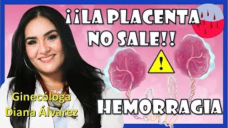 Lo que debes SABER RETENCION de PLACENTA Y HEMORRAGIA Posparto Ginecologa Diana Alvarez [upl. by Inaluahek804]