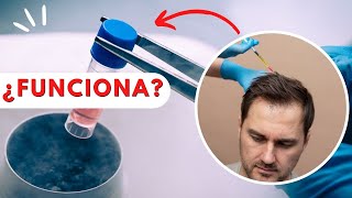 CÉLULAS MADRE para el cabello 💉🩸ALOPECIA [upl. by Ylrac]