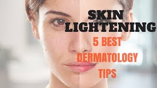 SKIN LIGHTENING 5 Best Dermatology Tips [upl. by Lesya]